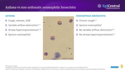 Inflammatory and airway smooth muscle cell interactions in asthma