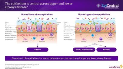 The role of the airway epithelium as a critical immune-functioning organ