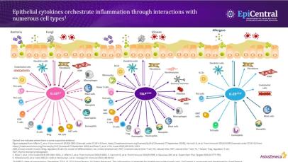 The role of epithelial cytokines in upper and lower airway disease thumbnail