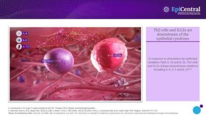 Asthma disease pathway image bank teaser