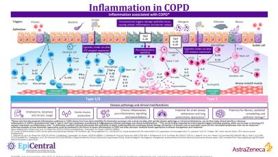 Inflammation in COPD teaser May 2025