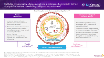 The role of the epithelium in the lower airway