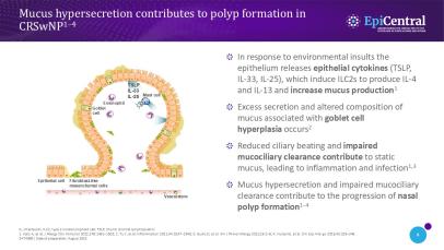 Mucus metaplasia and hypersecretion