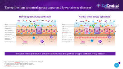 Epithelial dysfunction