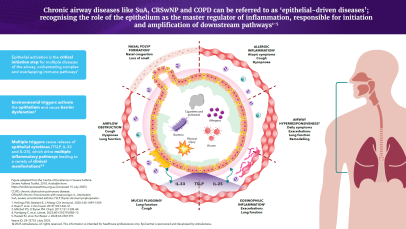 Epithelial-driven diseases infographic