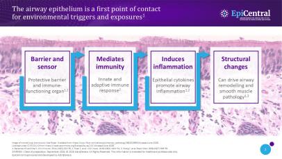 Slide showing how the airway epithelium is a first point of contact for environmental triggers and exposures.