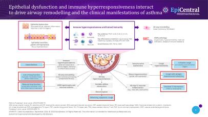 Slide showing how epithelial dysfunction and immune hyperresponsiveness drive airway remodelling and clinical features in asthma.