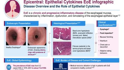 Epicentral: Epithelial Cytokines EoE infographic