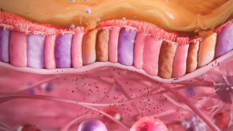 Complexity of severe asthma - module teaser image