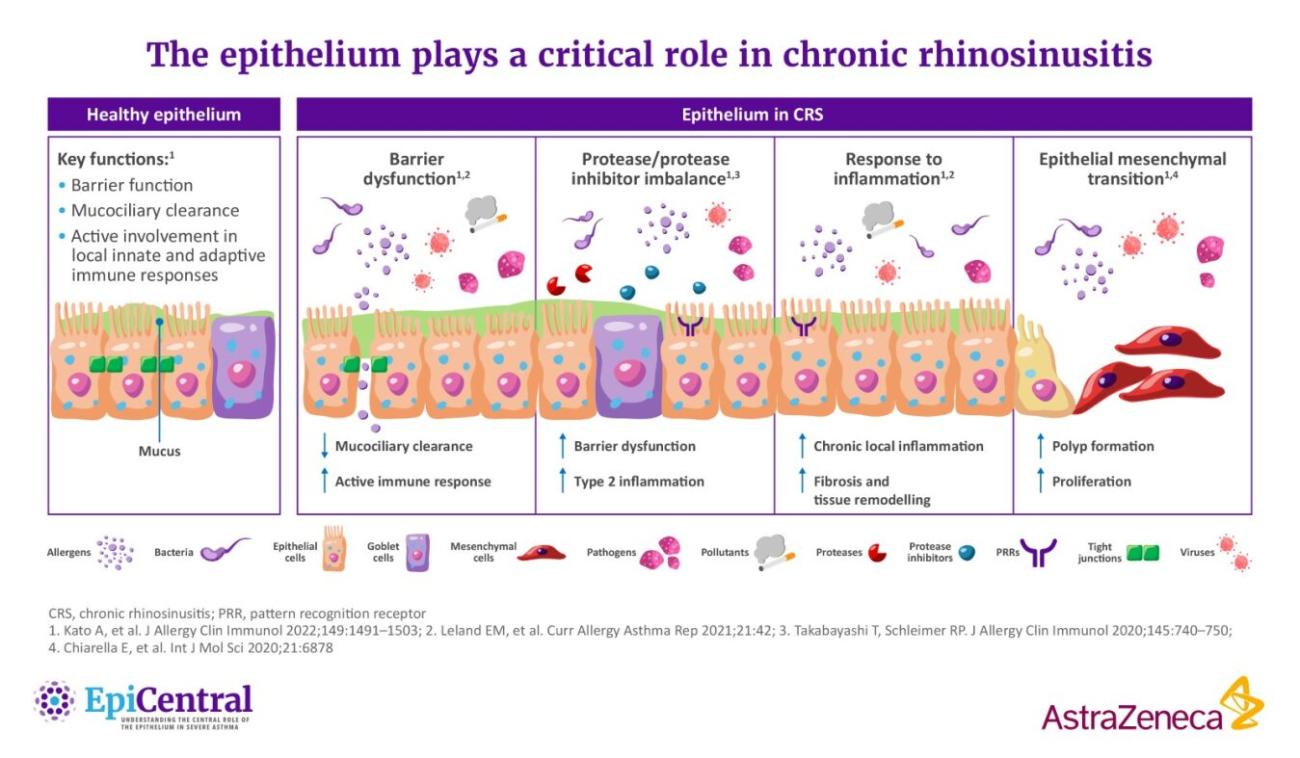 Epithelial barrier in CRS