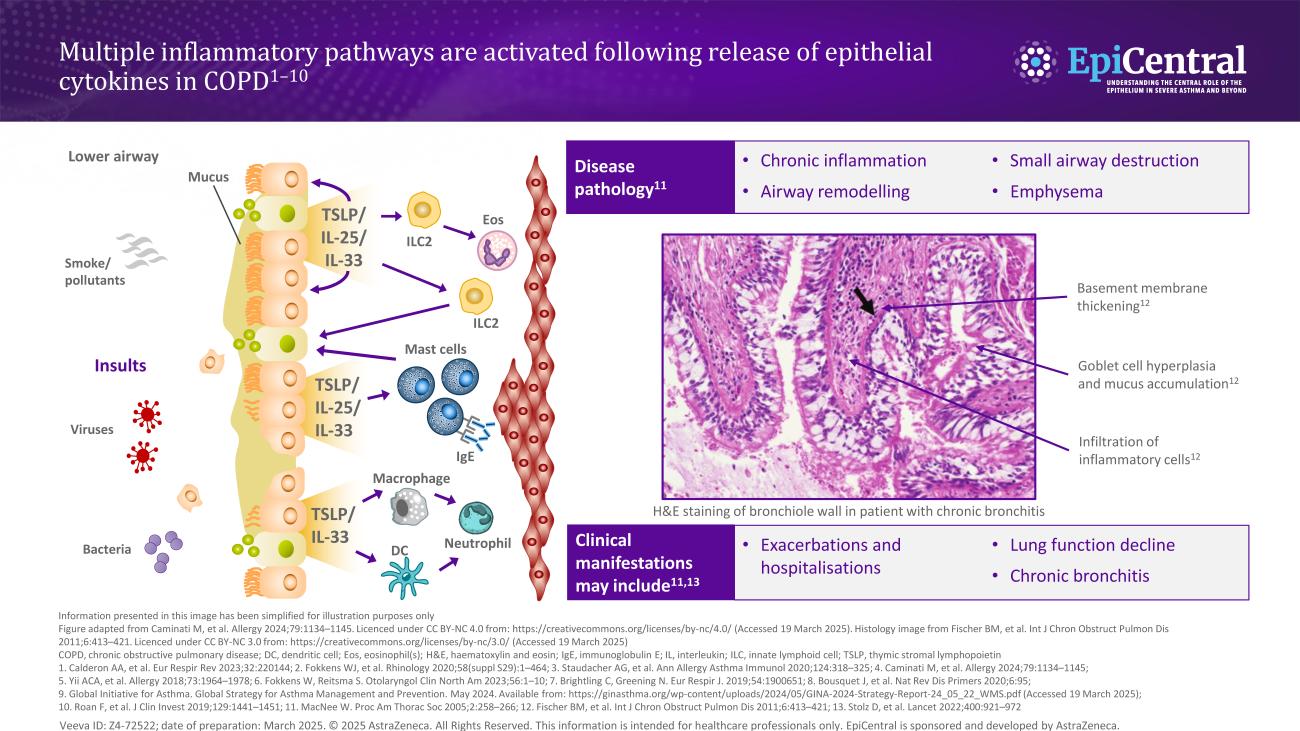 Inflammatory Pathways in COPD