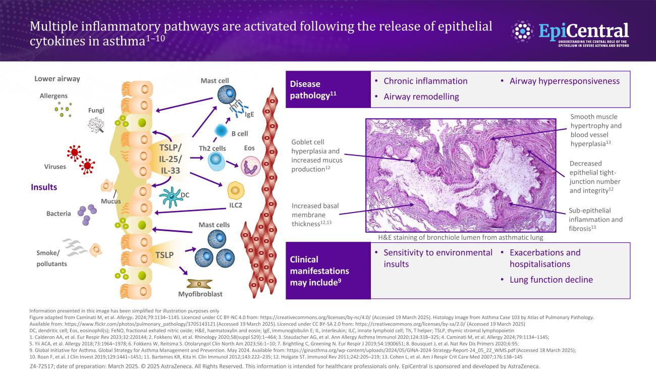 The inflammatory cascade in asthma: role of epithelial cytokines
