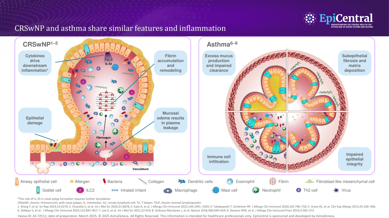 CRSwNP and asthma share similar features and inflammation