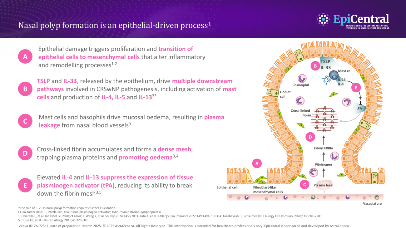 Nasal polyp formation is an epithelial-driven process
