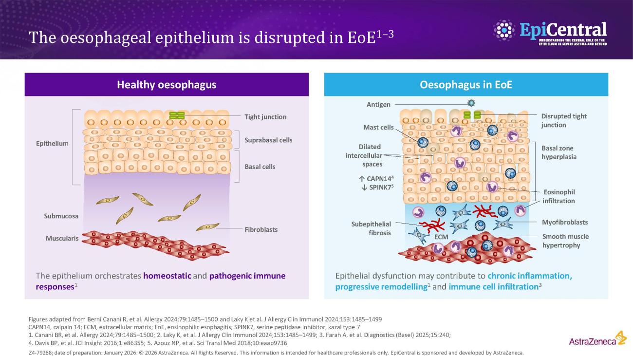 Diagrams showing the differences between healthy and EoE oesophageal epithelium.